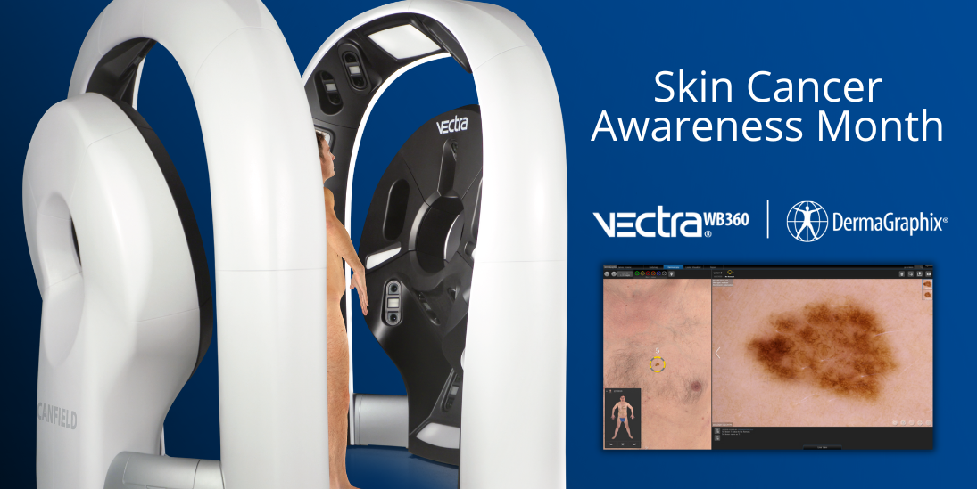 VECTRA WB360 in Skin Cancer Awareness Month